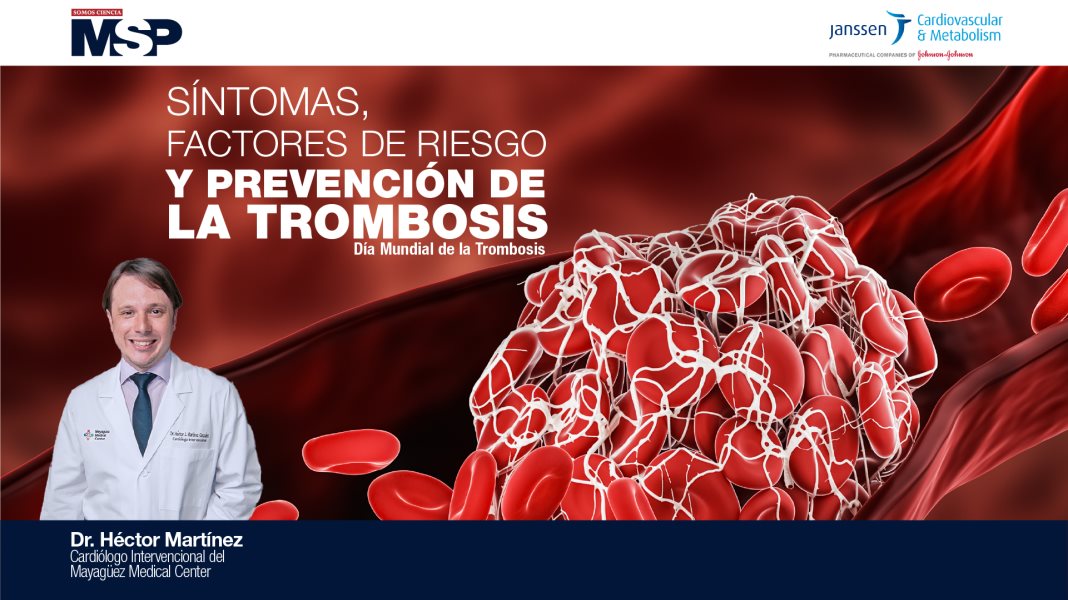 Síntomas, factores de riesgo y prevención de la trombosis