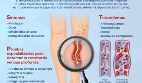 Criterios para el diagnóstico de la Trombosis Venosa Profunda