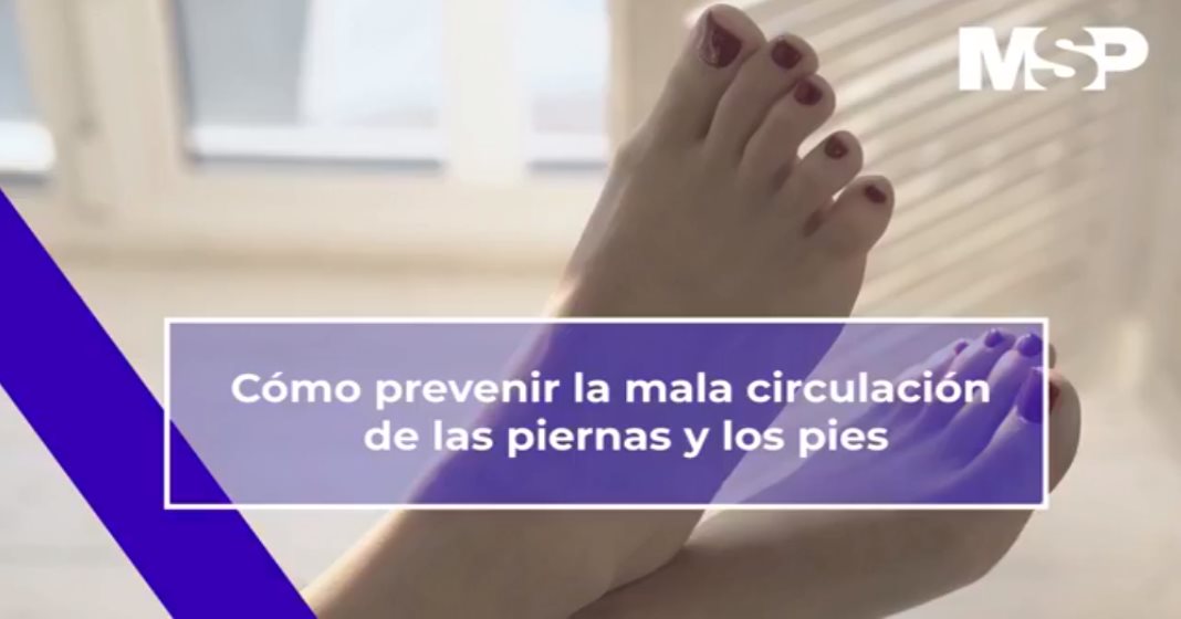 #ExclusivoMSP - Cómo prevenir la mala circulación de las piernas y los pies