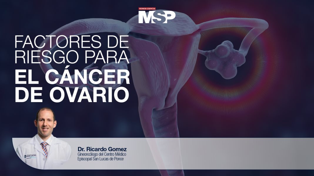 #ExclusivoMSP - Factores de riesgo para el cáncer de ovario
