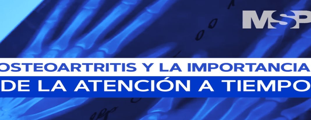 #ExclusivoMSP - Osteoartritis y la importancia de la atención a tiempo