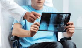 Científicos descubren nueva alternativa terapéutica para pacientes con esclerosis múltiple