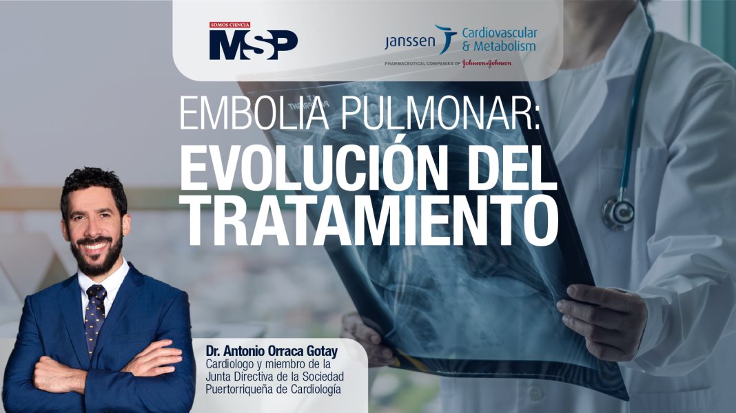 #ExclusivoMSP - Embolia pulmonar: Evolución del Tratamiento