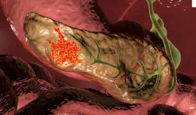 Estructuras de células inmunitarias podrían combatir el cáncer de páncreas