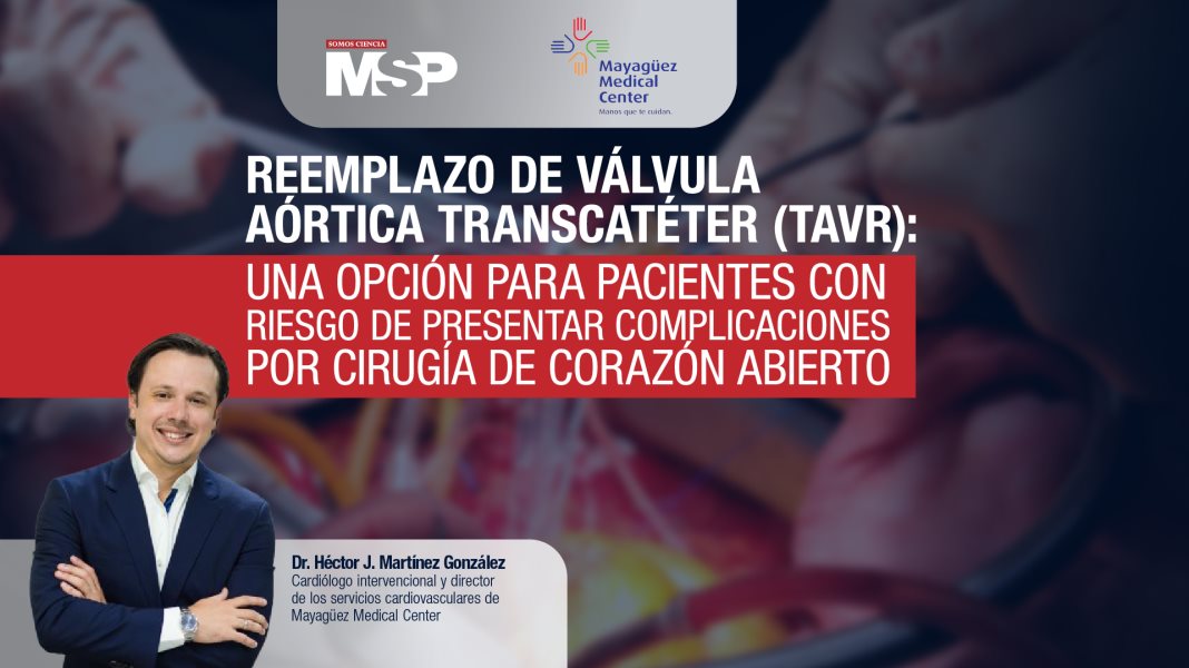 #ExclusivoMSP - Reemplazo de Válvula Aórtica Transcatéter