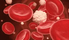 Un estudio sugiere que los orígenes de la diabetes pueden ser diferentes en hombres y mujeres