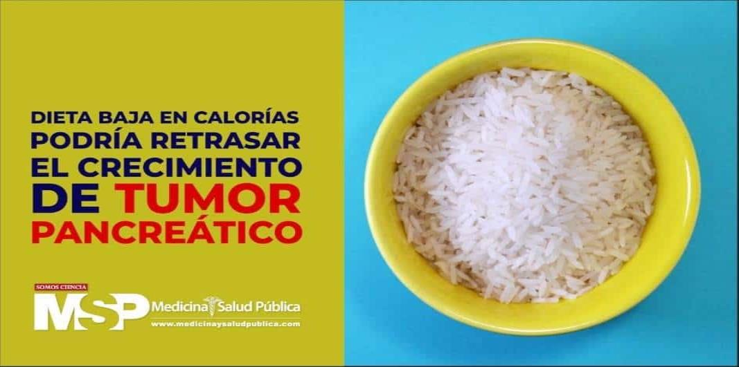 #ExclusivoMSP - Dieta baja en calorías podría retrasar el crecimiento de tumor pancreático