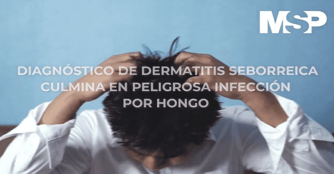 #ExclusivoMSP - Diagnóstico de dermatitis seborreica culmina en peligrosa infección por hongo
