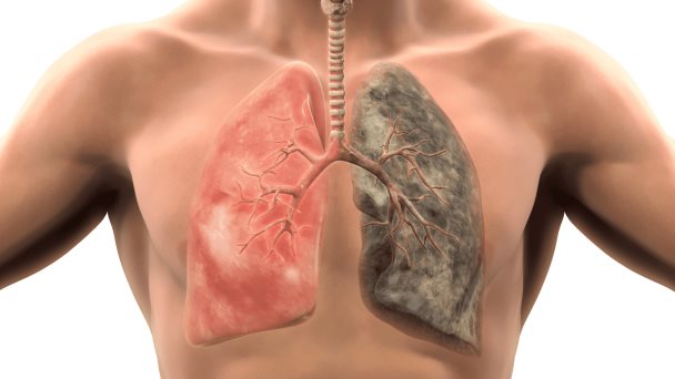 Test sanguíneo detecta de forma precisa un tipo de cáncer de pulmón en fase inicial Test sanguíneo detecta de forma precisa un tipo de cáncer de pulmón en fase inicial
