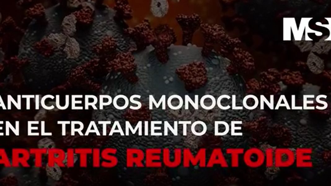 ExclusivoMSP - Anticuerpos monoclonales en el tratamiento contra la Artritis Reumatoide