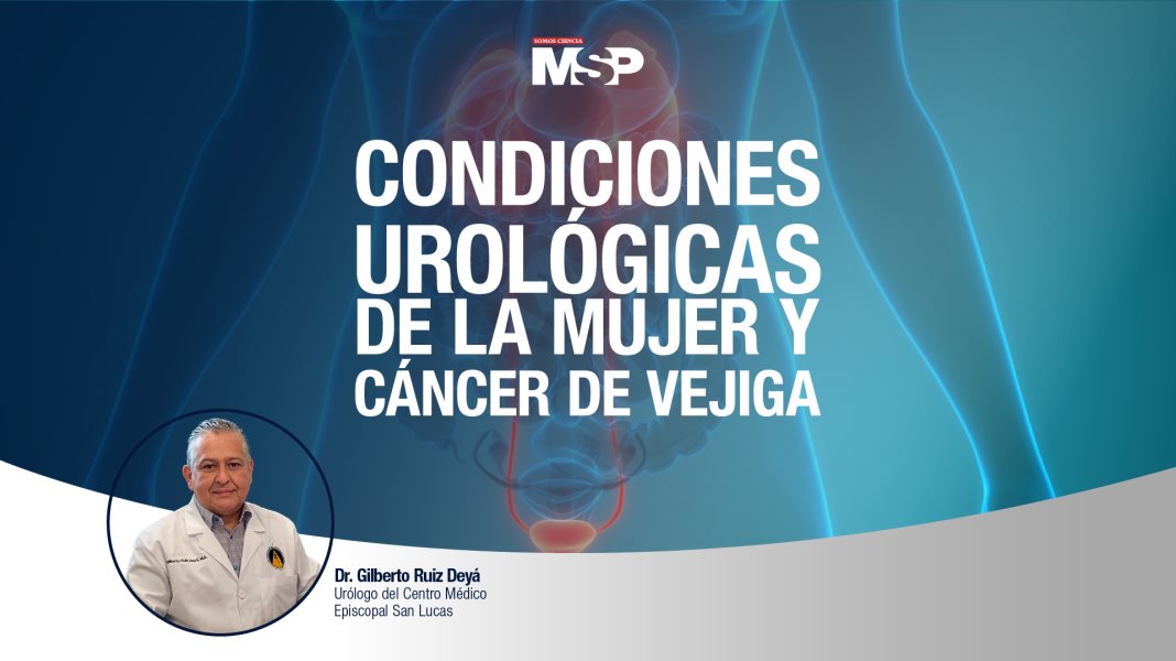 #ExclusivoMSP - Condiciones urológicas de la mujer y cáncer de vejiga