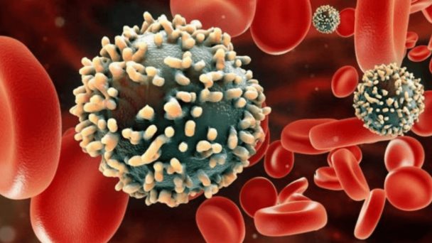 Estudio asegura que no ha disminuido cifras de contagio por VIH en población hispana y de raza negra Estudio asegura que no ha disminuido cifras de contagio por VIH en población hispana y de raza negra