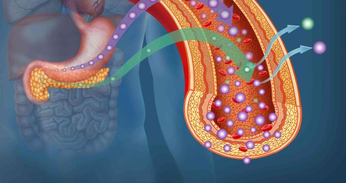 ¿Qué tan común es la remisión de pacientes con diabetes tipo 2?