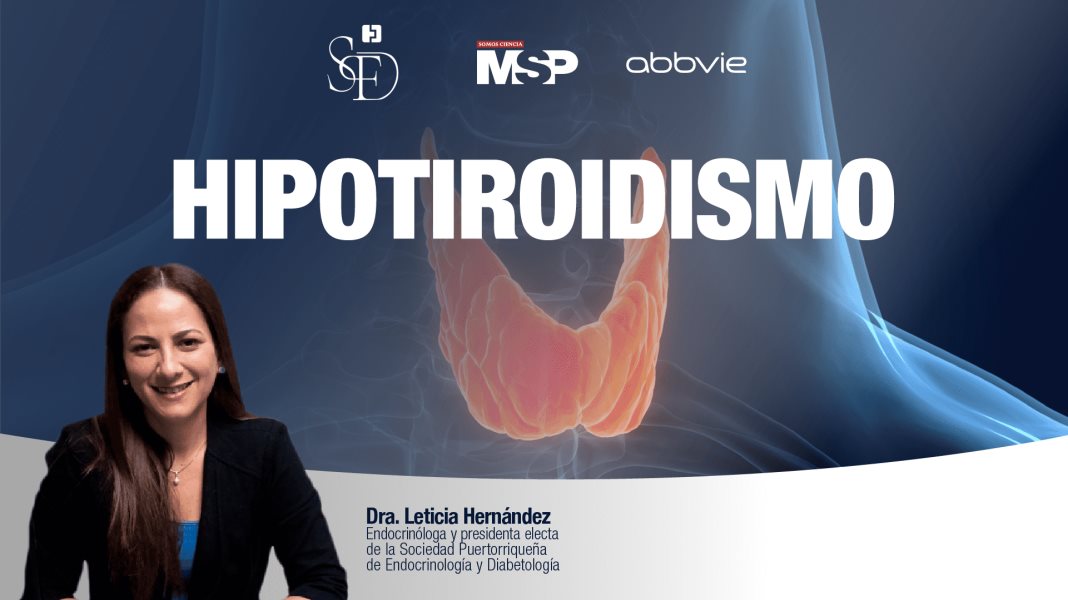#ExclusivoMSP - Hipotiroidismo con la Dra. Leticia Hernández