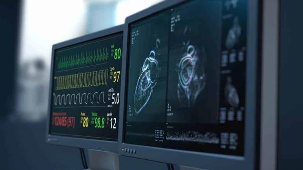 Estudio asocia alta frecuencia cardiaca en reposo con riesgo de demencia Estudio asocia alta frecuencia cardiaca en reposo con riesgo de demencia