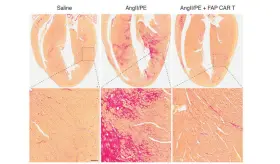 Investigación indica que la inmunoterapia podría ser utilizada para tratar la insuficiencia cardiaca