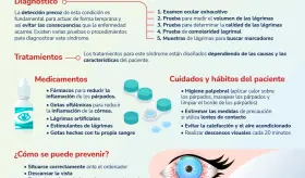 S&iacute;ndrome del Ojo Seco - Infograf&iacute;a