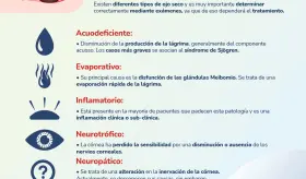 Tipos de Ojo Seco - Infograf&iacute;a