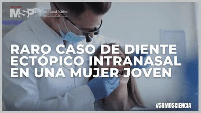 #ExclusivoMSP - Raro caso de diente ectópico intranasal en una mujer joven