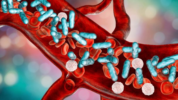 Identifican nueva diana terapéutica para el tratamiento de la sepsis Identifican nueva diana terapéutica para el tratamiento de la sepsis