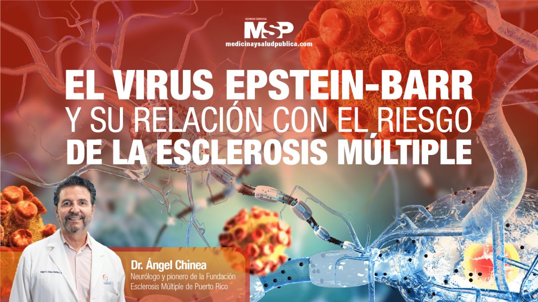 #ExclusivoMSP - El virus Epstein-Barr y su relación con el riesgo de la Esclerosis Múltiple