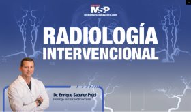 #ExclusivoMSP - Radiología Intervencional