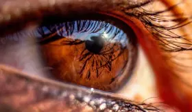 S&iacute;ntomas oculares en pacientes con ros&aacute;cea