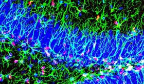 Descubierto un nuevo mecanismo para activar las células madre del cerebro adulto