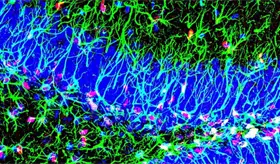 Descubierto un nuevo mecanismo para activar las c&eacute;lulas madre del cerebro adulto