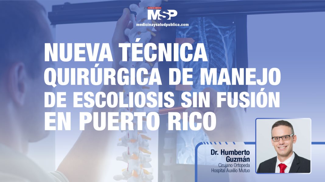 #ExclusivoMSP - Nueva técnica quirúrgica de manejo de escoliosis sin fusión en Puerto Rico