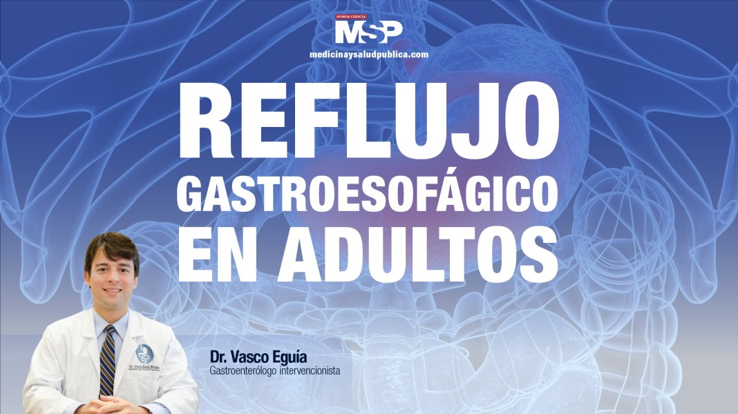 #ExclusivoMSP - Reflujo Gastroesofágico en adultos