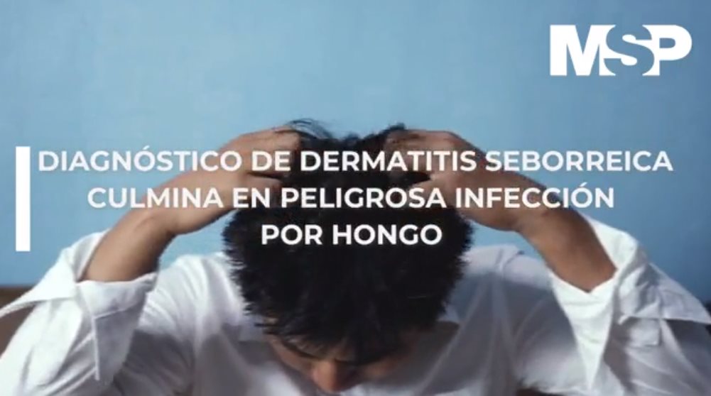 #ExclusivoMSP - Diagnóstico de dermatitis seborreica culmina en peligrosa infección por hongo