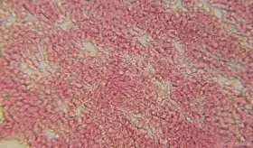 La mitad de las mujeres notifican alteraciones en ciclo menstrual tras vacunarse o tener Covid-19