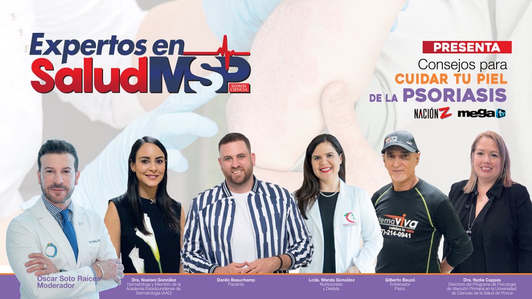 #ExclusivoMSP - Consejos para cuidar tu piel de la Psoriasis