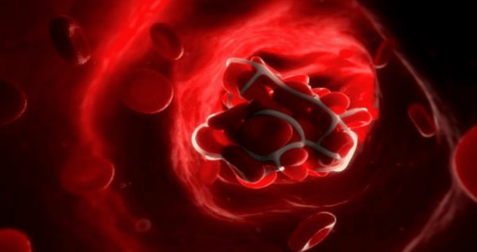 FDA aprueba el primer fármaco para la mielofibrosis con trombocitopenia