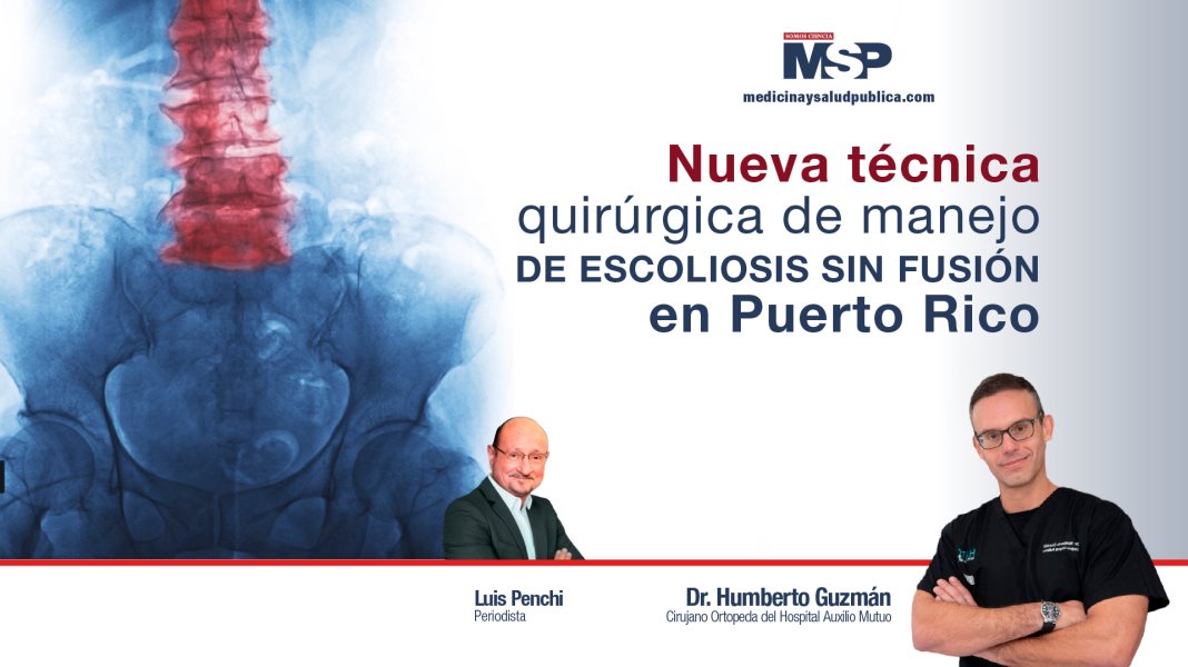 Nueva técnica quirúrgica de manejo de escoliosis sin fusión en Puerto Rico - #ExclusivoMSP