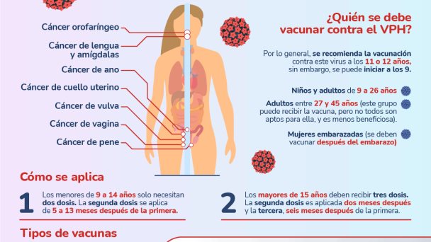 Vacunación contra el VPH - Infografía Vacunación contra el VPH - Infografía