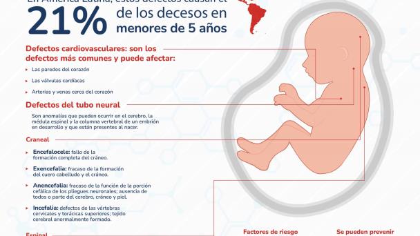 Defectos del nacimiento - Infografía