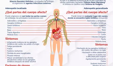 Linfoma Hodgkin vs Linfoma no Hodgkin