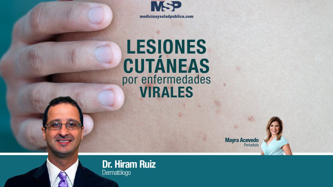 #ExclusivoMSP I Lesiones cutáneas por enfermedades virales
