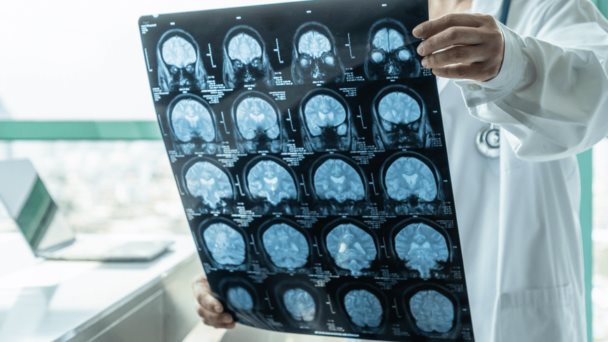 La soledad se asocia con enfermedades cerebrales y cardiovasculares, según investigación La soledad se asocia con enfermedades cerebrales y cardiovasculares, según investigación