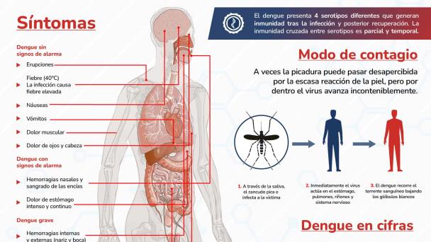 Dengue - Infografía Dengue - Infografía