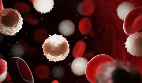 Leucemia mieloide aguda: identifican nuevos subtipos de la enfermedad