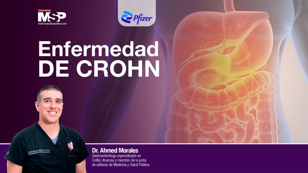 Enfermedad de Crohn con el Dr. Ahmed Morales - #ExclusivoMSP