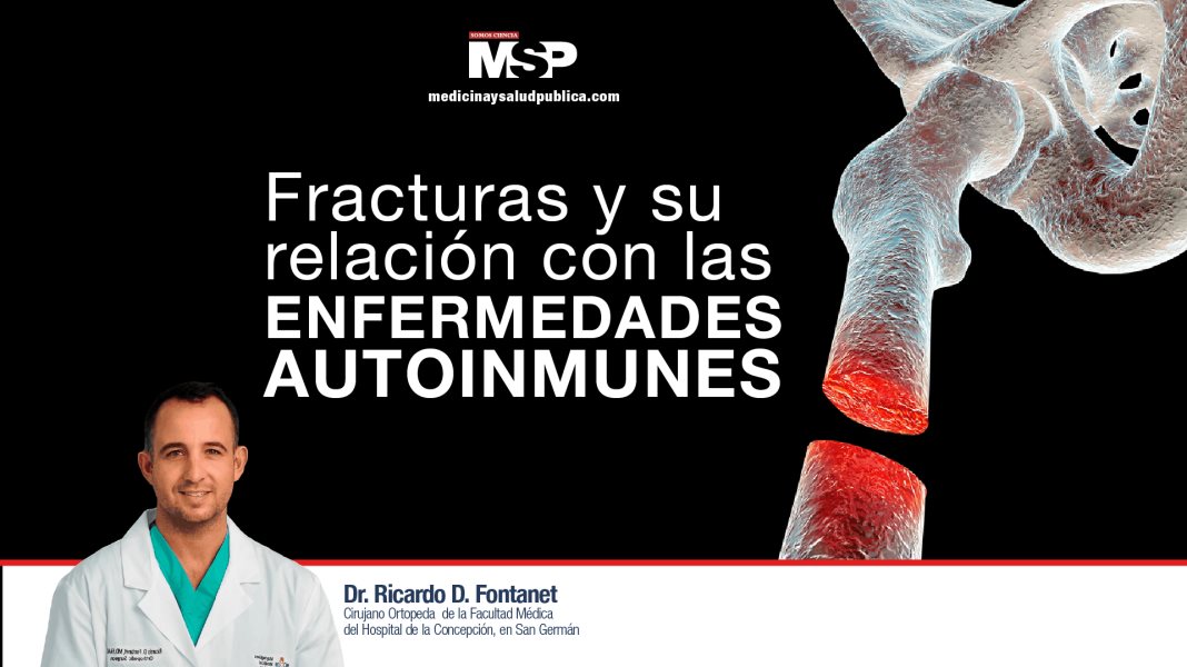 Fracturas y su relación con las enfermedades autoinmunes - #ExclusivoMSP