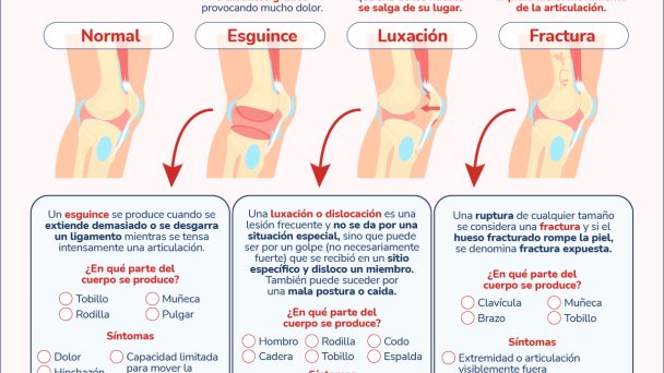 Esguince vs luxación y fractura - Infografía Esguince vs luxación y fractura - Infografía