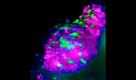 Un estudio aumenta radicalmente la eficacia de la inmunoterapia en un tipo de cáncer de mama