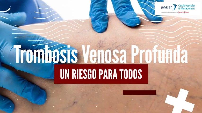 Trombosis Venosa Profunda un riesgo para todos