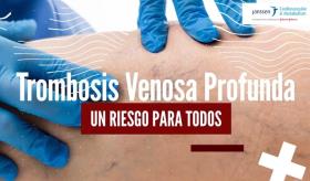 Trombosis Venosa Profunda un riesgo para todos