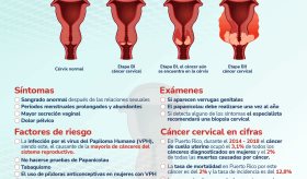 Cáncer de Cuello Uterino - Infografía